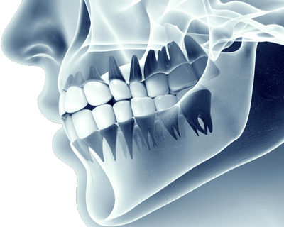 dental x-ray